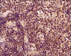 ROR gamma/RORC/NR1F3 Antibody - BSA Free, Novus Biologicals:Antibodies:Primary