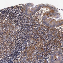 RP2 Antibody, Novus Biologicals:Antibodies:Primary Antibodies