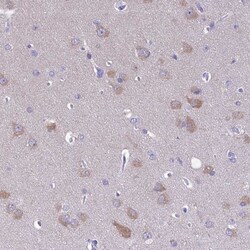 RP5-1077B9.4 Antibody, Novus Biologicals:Antibodies:Primary Antibodies