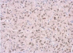 RPA14 Antibody (11.1), Novus Biologicals 0.1mg; Unlabeled:Antibodies, Monoclonal