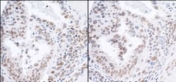 RPA70 Antibody, Novus Biologicals 0.1mg; Unlabeled:Antibodies, Polyclonal