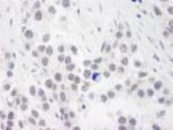 RPA70 Antibody, Novus Biologicals 0.1mg; Unlabeled:Antibodies, Polyclonal