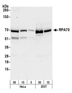 RPA70 Antibody, Novus Biologicals 0.1mg; Unlabeled:Antibodies, Polyclonal
