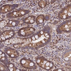 RPAP2 Antibody, Novus Biologicals:Antibodies:Primary Antibodies