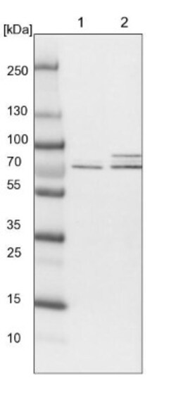 RPC62 Antibody, Novus Biologicals 0.1mL; Unlabeled:Antibodies, Polyclonal