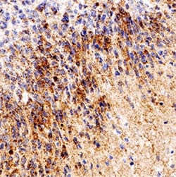 RPE65 Antibody (401.8B11.3D9) - BSA Free, Novus Biologicals 0.025mL; Unlabeled:Antibodies,