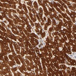 RPGR Antibody, Novus Biologicals 0.1mL; Unlabeled:Antibodies, Polyclonal
