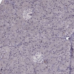 RPGRIP1 Antibody, Novus Biologicals 25ul | Buy Online | Novus Biologicals | Fisher Scientific