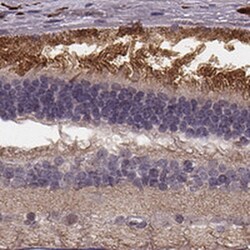 RPGRIP1 Antibody, Novus Biologicals 25ul | Buy Online | Novus Biologicals | Fisher Scientific