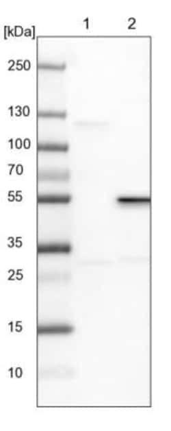 RPIP8 Antibody, Novus Biologicals 25 &mu;L; Unlabeled:Antibodies, Polyclonal