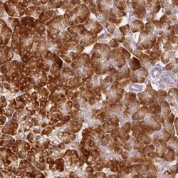 RPL10A Antibody, Novus Biologicals 0.1mL; Unlabeled:Antibodies, Polyclonal