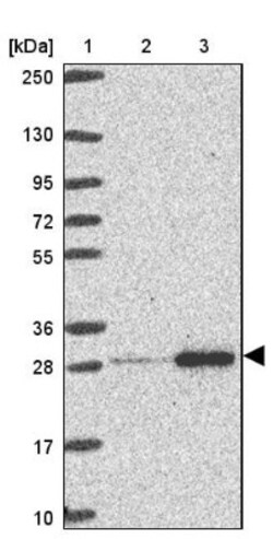 RPL10A Antibody, Novus Biologicals 0.1mL; Unlabeled:Antibodies, Polyclonal