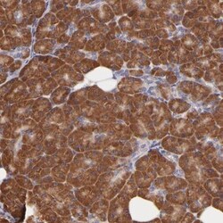 RPL11 Antibody, Novus Biologicals 0.1mL; Unlabeled:Antibodies, Polyclonal