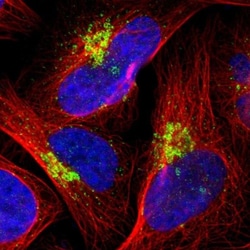 RPL12 Antibody, Novus Biologicals 0.1mL; Unlabeled:Antibodies, Polyclonal