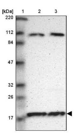 RPL12 Antibody, Novus Biologicals 0.1mL; Unlabeled:Antibodies, Polyclonal