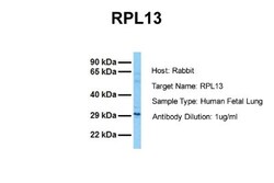 RPL13 Antibody, Novus Biologicals 0.05mg; Unlabeled:Antibodies, Polyclonal