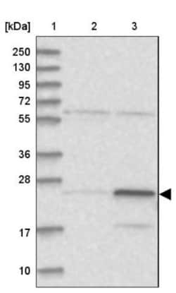 RPL13A Antibody, Novus Biologicals 0.1mL; Unlabeled:Antibodies, Polyclonal