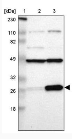RPL14 Antibody, Novus Biologicals 25 &mu;L | Buy Online | Novus Biologicals | Fisher Scientific