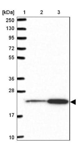 RPL18 Antibody, Novus Biologicals 0.1mL; Unlabeled:Antibodies, Polyclonal