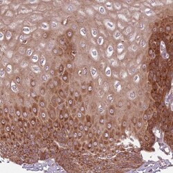 RPL21 Antibody, Novus Biologicals:Antibodies:Primary Antibodies