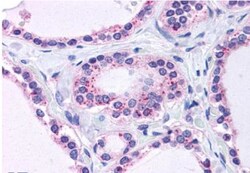 RPL22 Antibody, Novus Biologicals 0.1mg; Unlabeled:Antibodies, Polyclonal