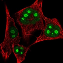 RPL24/RLP24 Antibody, Novus Biologicals:Antibodies:Primary Antibodies