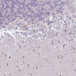 RPL24/RLP24 Antibody, Novus Biologicals:Antibodies:Primary Antibodies