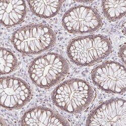 RPL24/RLP24 Antibody, Novus Biologicals:Antibodies:Primary Antibodies