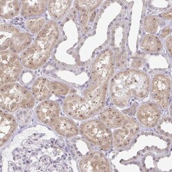 RPL24/RLP24 Antibody, Novus Biologicals:Antibodies:Primary Antibodies