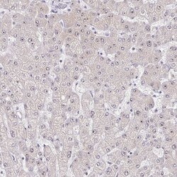 RPL24/RLP24 Antibody, Novus Biologicals:Antibodies:Primary Antibodies