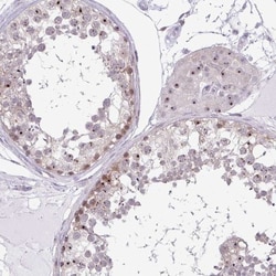 RPL24/RLP24 Antibody, Novus Biologicals:Antibodies:Primary Antibodies