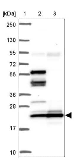 RPL24/RLP24 Antibody, Novus Biologicals:Antibodies:Primary Antibodies