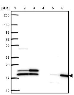 RPL24/RLP24 Antibody, Novus Biologicals:Antibodies:Primary Antibodies