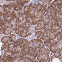 RPL27A Antibody, Novus Biologicals 25 &mu;L, Unlabeled:Antibodies, Polyclonal