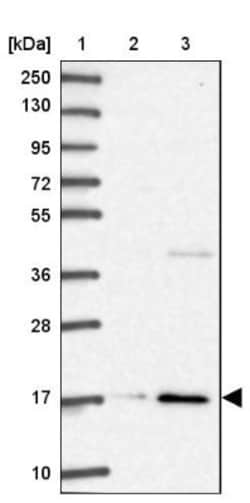 RPL28 Antibody, Novus Biologicals 25 &mu;L, Unlabeled:Antibodies, Polyclonal