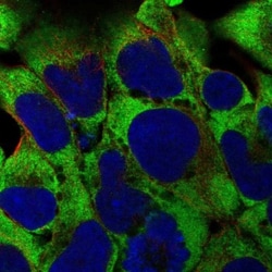 RPL38 Antibody, Novus Biologicals 25 &mu;L, Unlabeled:Antibodies, Polyclonal