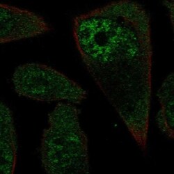 RPL3L Antibody, Novus Biologicals 0.1mL; Unlabeled:Antibodies, Polyclonal