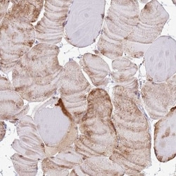 RPL3L Antibody, Novus Biologicals 0.1mL; Unlabeled:Antibodies, Polyclonal