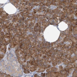 RPL4 Antibody, Novus Biologicals:Antibodies:Primary Antibodies