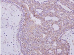 RPL6 Antibody, Novus Biologicals 0.1mL; Unlabeled:Antibodies, Polyclonal