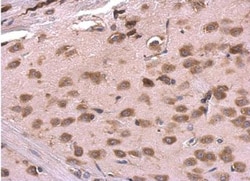 RPL6 Antibody, Novus Biologicals 0.1mL; Unlabeled:Antibodies, Polyclonal
