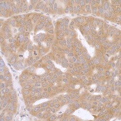 RPL7 Antibody, Novus Biologicals 0.1mL; Unlabeled:Antibodies, Polyclonal