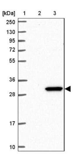 RPL8 Antibody, Novus Biologicals 25 &mu;L; Unlabeled:Antibodies, Polyclonal