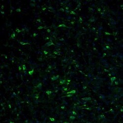 RPL9 Antibody, Novus Biologicals 0.1mL; Unlabeled:Antibodies, Polyclonal