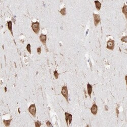 RPL9 Antibody, Novus Biologicals 0.1mL; Unlabeled:Antibodies, Polyclonal