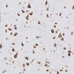 RPL9 Antibody, Novus Biologicals 0.1mL; Unlabeled:Antibodies, Polyclonal