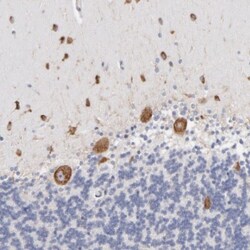 RPL9 Antibody, Novus Biologicals 0.1mL; Unlabeled:Antibodies, Polyclonal