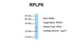 RPLP0 Antibody, Novus Biologicals 0.1mg; Unlabeled:Antibodies, Polyclonal