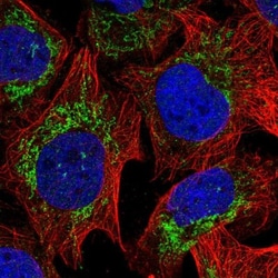 RPLP2 Antibody, Novus Biologicals:Antibodies:Primary Antibodies