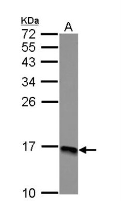 RPLP2 Antibody, Novus Biologicals 0.1mL; Unlabeled:Antibodies, Polyclonal